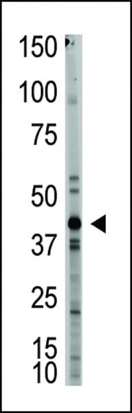 MSTN / GDF8 / Myostatin Antibody (aa9-38)