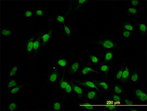 Monoclonal Mouse anti-Human HEYL Antibody (clone 1F6, IHC, IF, WB)