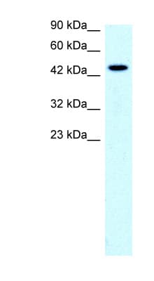 Polyclonal Rabbit anti-Human SLC17A2 Antibody (aa230-279, IHC, WB)
