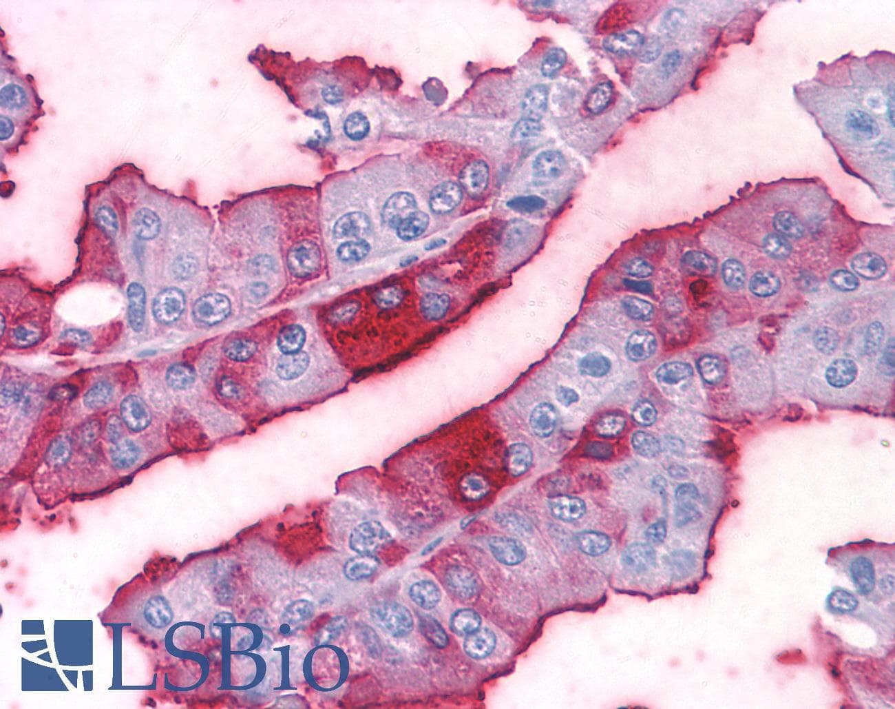 PathPlus™ MC4R / Melanocortin 4 Receptor Antibody (N-Terminus)