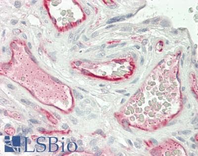 IHC-plus™ TSG101 Antibody