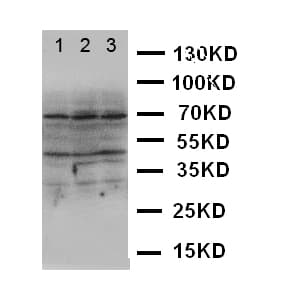 Polyclonal Rabbit anti-Human DAPK2 / DAP Kinase 2 Antibody (aa289-308, WB)
