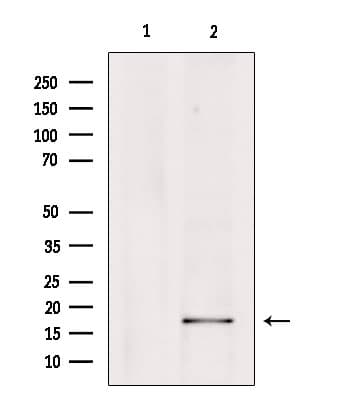 Polyclonal Rabbit anti-Human PGES / PTGES Antibody (IHC, WB)