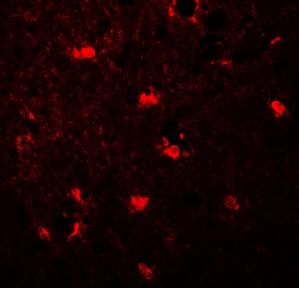 IHC-plus™ Polyclonal Rabbit anti-Human MAP1LC3C / LC3C Antibody (IHC, IF, WB)