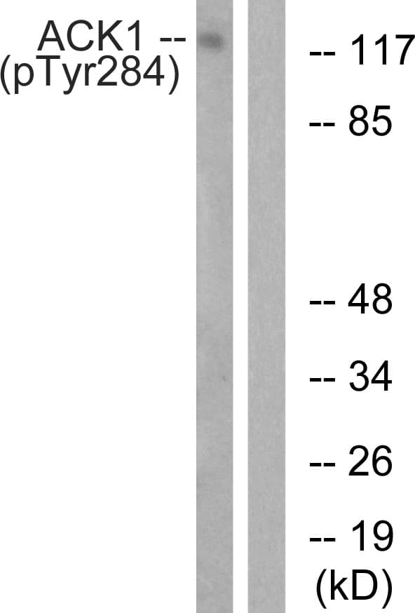 TNK2 / ACK1 Antibody (phospho-Tyr284)