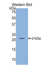 GKN2 / Gastrokine 2 Antibody (aa21-184)