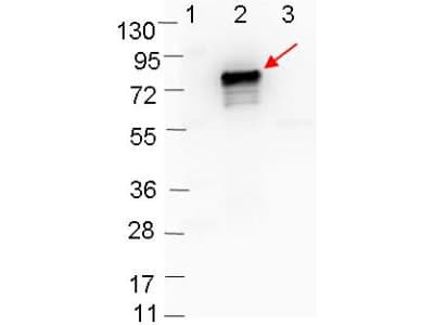 Polyclonal Rabbit anti-Borrelia burgdorferi Borrelia burgdorferi OspB Antibody (Liquid, WB)