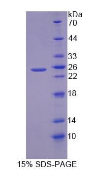 Human TRPC6 Protein (Recombinant His-S)