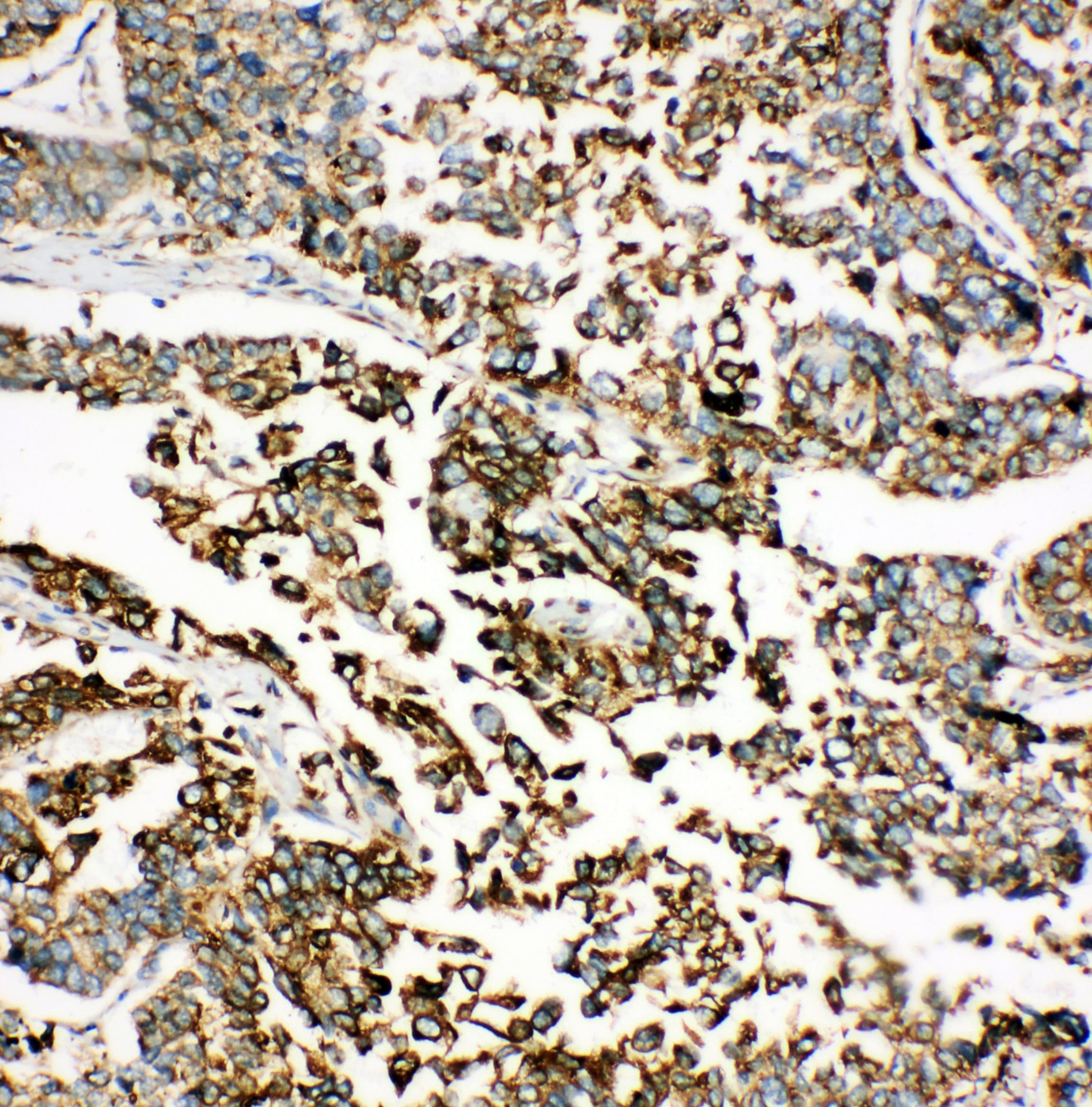 HSPA5 / GRP78 / BiP Antibody (aa603-617)