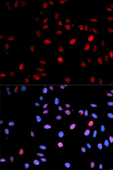 TP53 / p53 Antibody (phospho-Ser15)