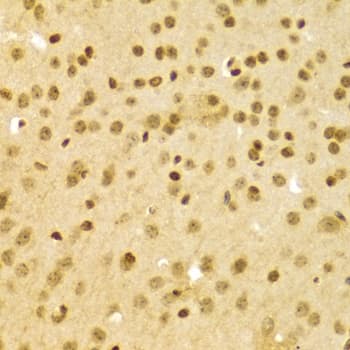 Polyclonal Rabbit anti-Human DKC1 / Dyskerin Antibody (IHC, IF, WB)