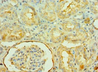 Polyclonal Rabbit anti-Human NAMPT / Visfatin Antibody (aa1-280, IHC)