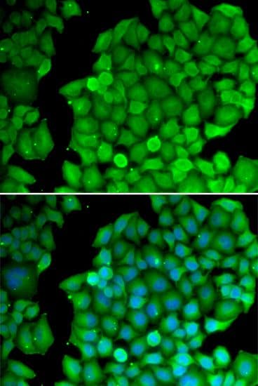 CCND2 / Cyclin D2 Antibody