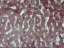MMP13 Antibody (aa104-471, clone OTI2D8)