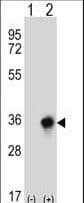 CBR3 Antibody (aa195-224)