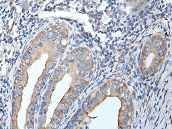 HSPB1 / HSP27 Antibody