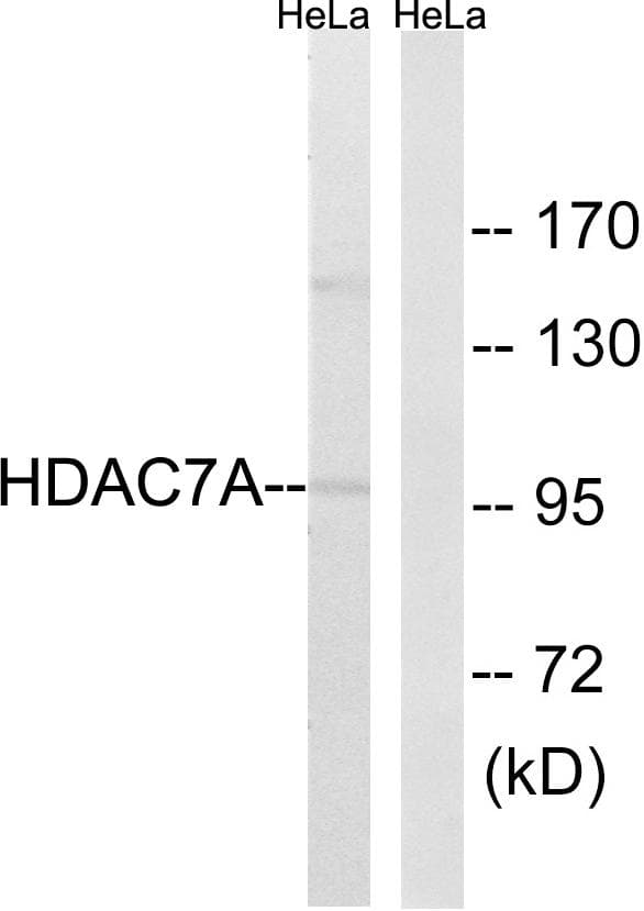 HDAC7 Antibody (p155)