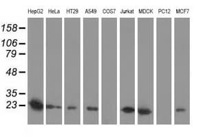 SOD2 / Mn SOD Antibody (clone OTI1H6)
