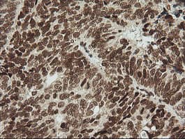 ZSCAN18 / ZNF447 Antibody (clone OTI2H7, Carrier-free)