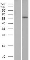 ZNF286B Protein (Over-Expression Lysate Myc-DDK (Flag))