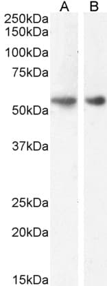 GLP1R / GLP-1 Receptor Antibody (aa211-222)