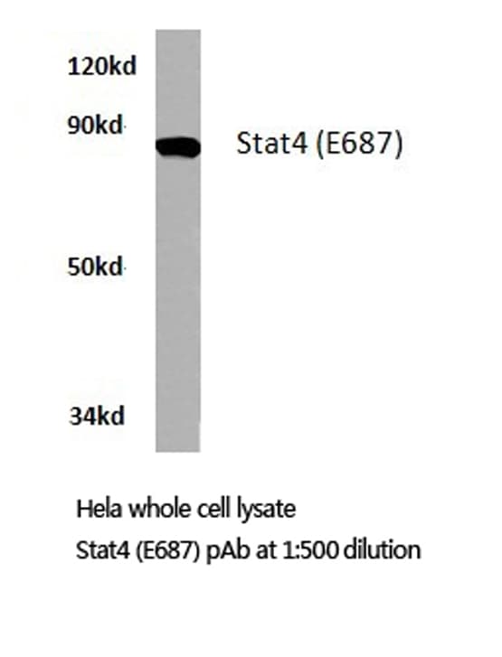 STAT4 Antibody (Glu687)