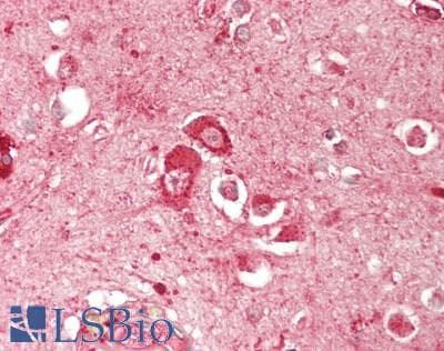 IHC-plus™ ARSA / Arylsulfatase A Antibody
