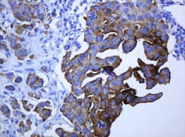 KRT5 / CK5 / Cytokeratin 5 Antibody (aa1-273, clone OTI1E7)