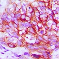 EGFR Antibody (C-Terminus)