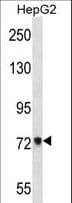 IHC-plus™ Polyclonal Rabbit anti-Human ACSS2 / ACAS2 Antibody (aa261-290, IHC, WB)