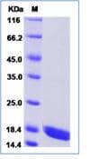 Human IL17A+IL17F Protein (Recombinant)