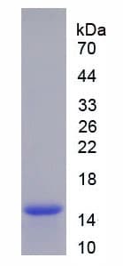 Human CDK1 / CDC2 Protein (Recombinant His)