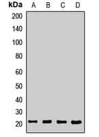 SPC18 / SEC11A Antibody