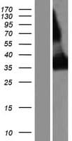 CD1E Protein (Over-Expression Lysate Myc-DDK (Flag))