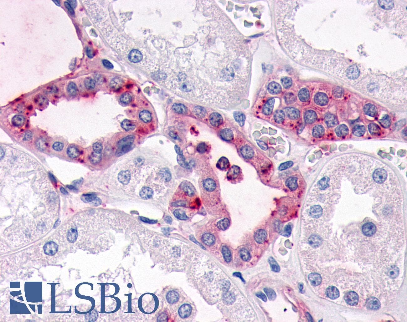 PathPlus™ SGK3 Antibody (N-Terminus)