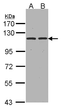 IHC-plus™ ENPEP / Aminopeptidase A Antibody