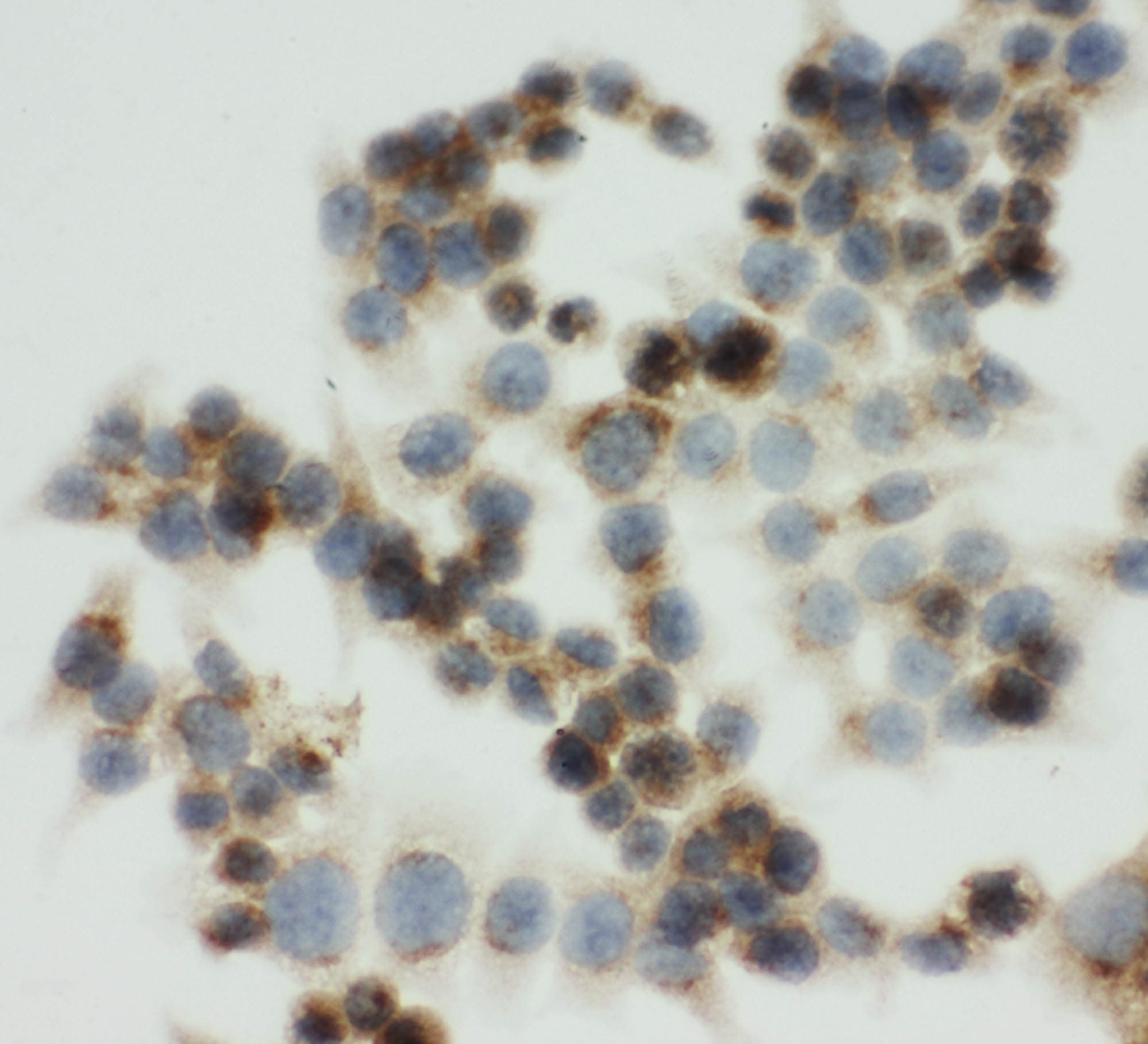 Polyclonal Rabbit anti-Human IGF2R / CD222 Antibody (aa2475-2491, IHC, WB)