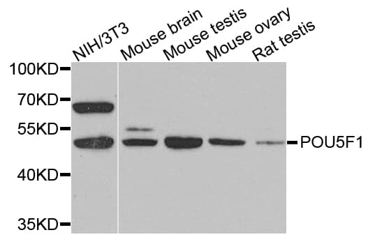 POU5F1 / OCT4 Antibody