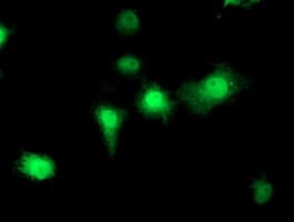 EIF2B3 Antibody (clone OTI2H1)