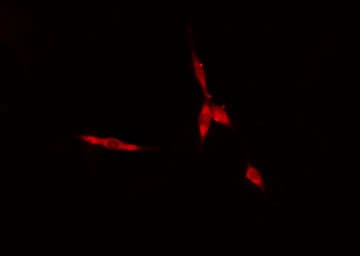 Polyclonal Rabbit anti-Human UCHL1 / PGP9.5 Antibody (IHC, IF, WB)
