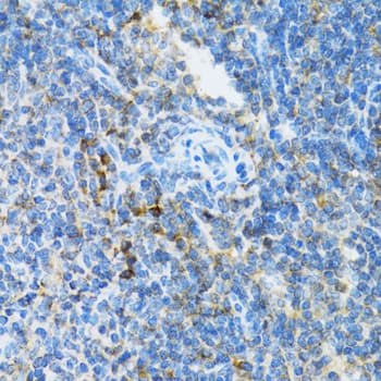 UBE2D1 / UBCH5 Antibody