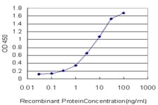 IHC-plus™ Monoclonal Mouse anti-Human STI1 / STIP1 Antibody (clone 1E3, IHC, IF, WB)
