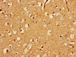FBXO25 Antibody