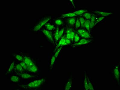 Histone H2B Antibody