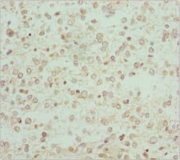 RCN2 Antibody