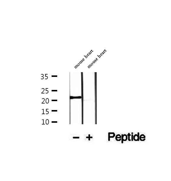 Polyclonal Rabbit anti-Human COQ7 Antibody (IHC, IF, WB)
