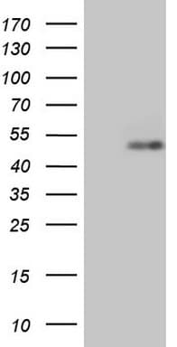 RORB / ROR Beta Antibody (aa1-260, clone OTI4B7)