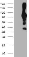 PFKP Antibody (clone OTI1A11)
