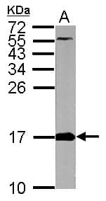 Polyclonal Rabbit anti-Human FIS1 Antibody (aa1-152, IHC, WB)