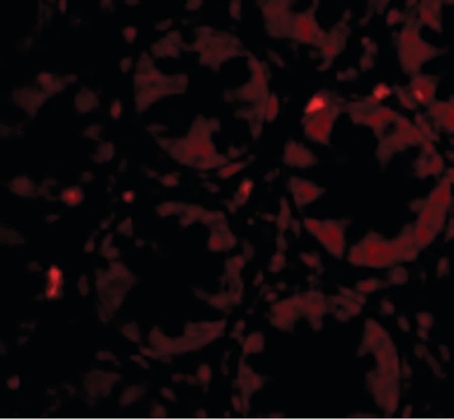 IHC-plus™ Polyclonal Rabbit anti-Human CCK4 / PTK7 Antibody (IHC, IF, WB)